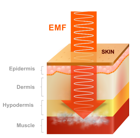 Wireless EMF energy from devices is absorbed into the body